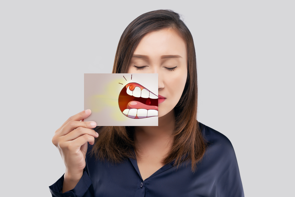 oral cancer